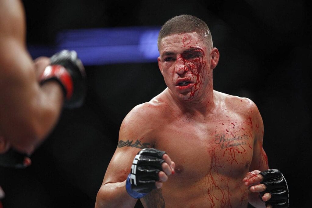 diego sanchez conor mcgregor