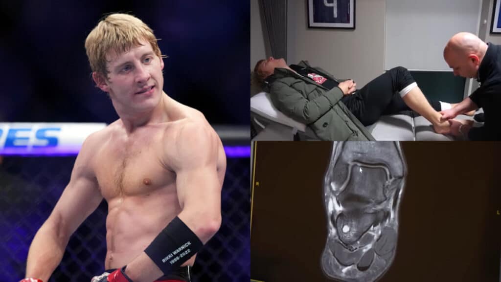 Paddy Pimblett ankle UFC London