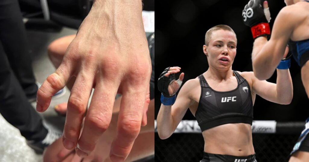 Photo - Rose Namajunas Shows Off Grisly Hand Injury Suffered In Bloody ...