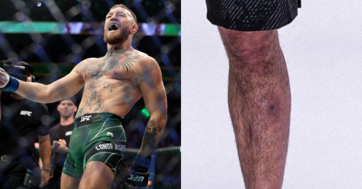 Conor McGregor rips Islam Makhachev amid speculation over infection pre UFC 302 this inbred lives with staph