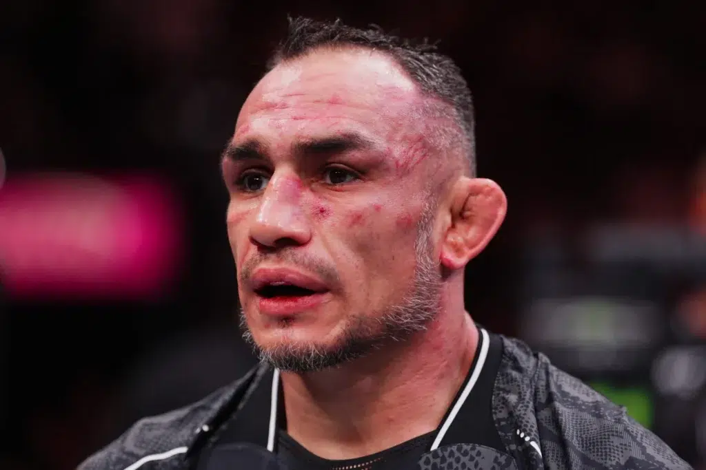 Tony Ferguson