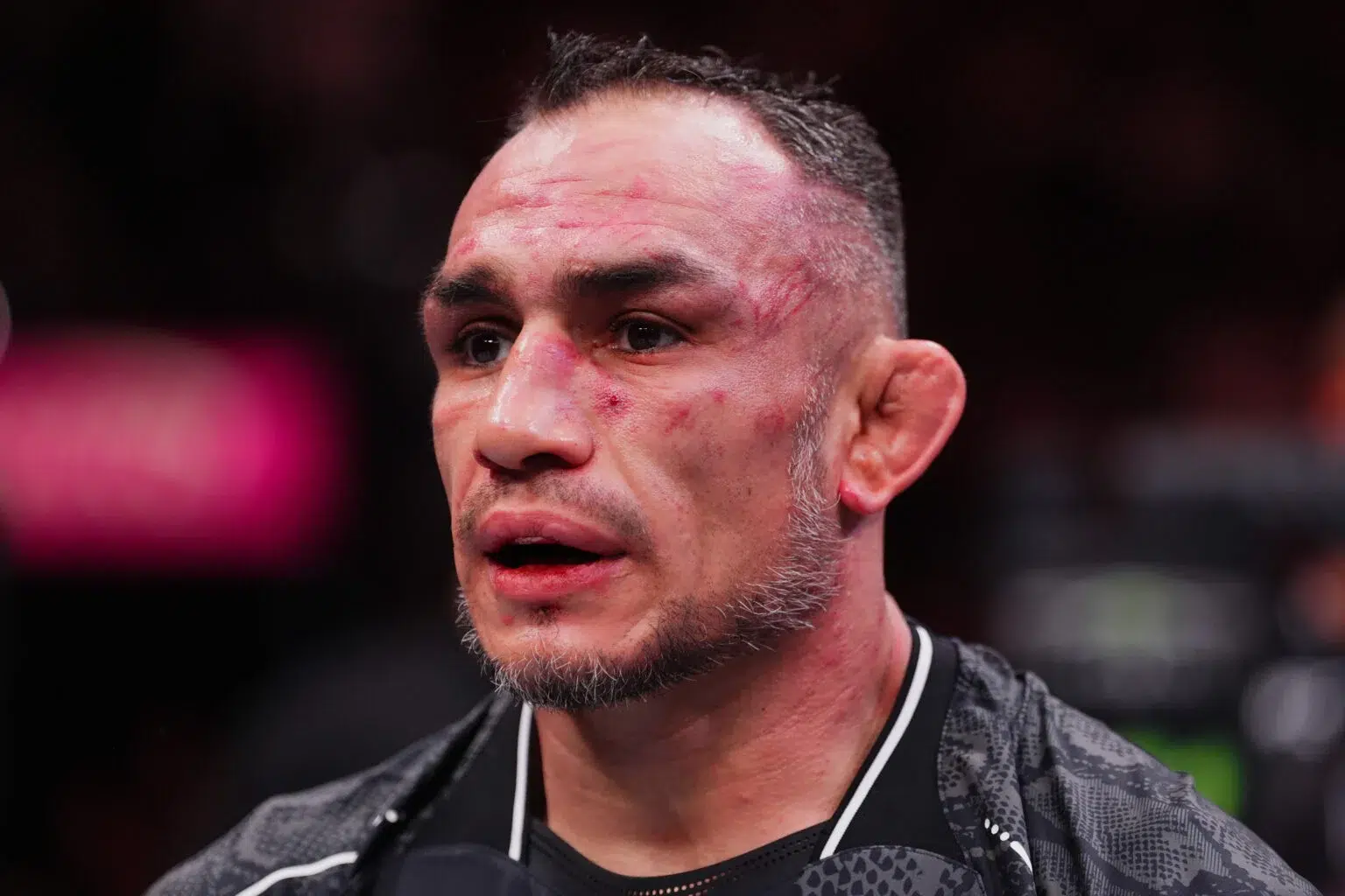 Tony Ferguson