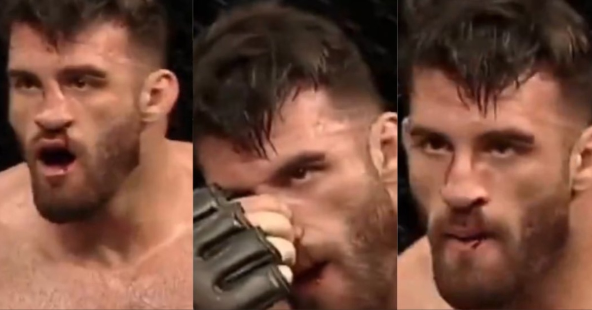 Video: MMA Fighter Resets Crooked, Broken Nose Mid-Fight