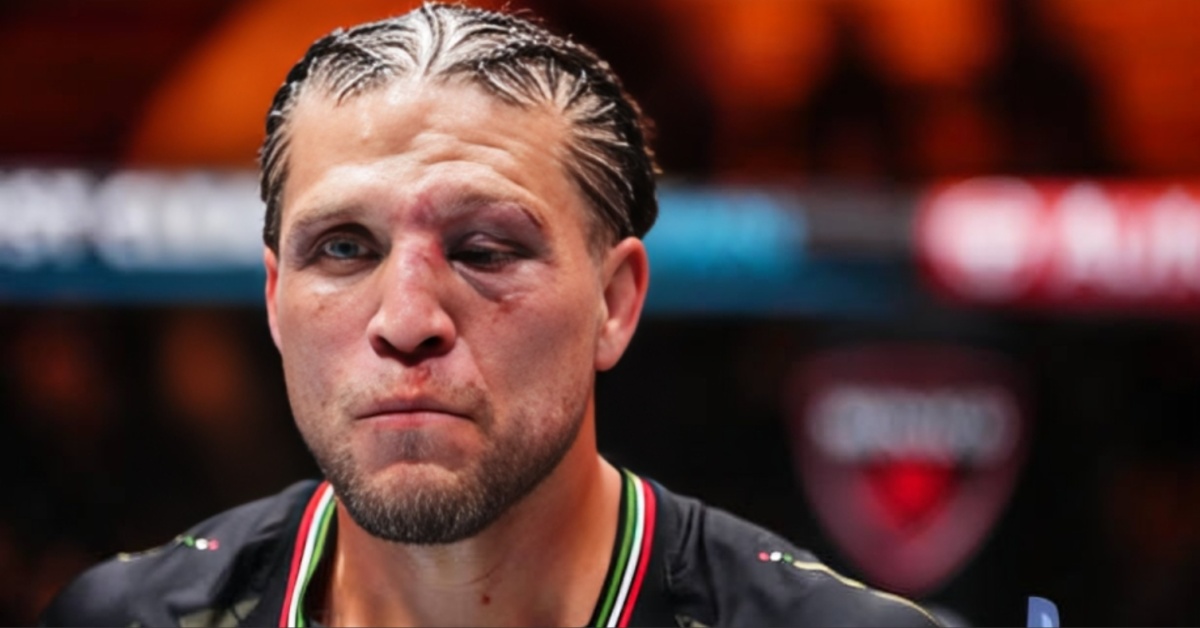 NSFW: Brian Ortega's gory eye injury revealed by Dana White post-UFC 306