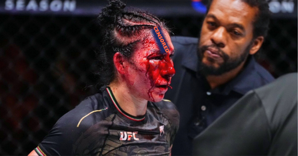 NSFW Gore: Irene Aldana's gruesome forehead cut: One of the worst in MMA history?