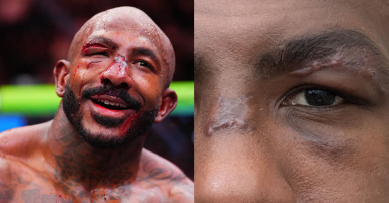 Photos - Khalil Rountree shows off gruesome scars after UFC 307 title fight with Alex Pereira