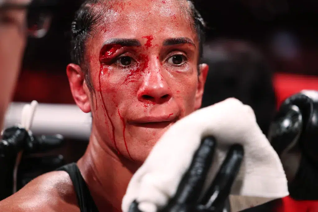 amanda serrano getty cut 3