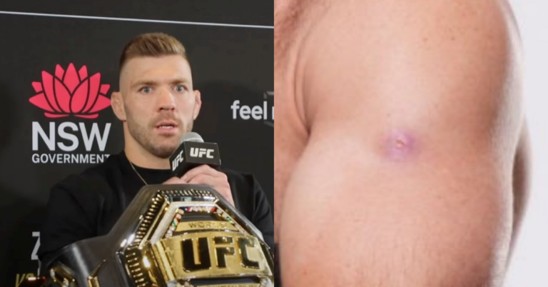 Dricus du Plessis suggests Sean Strickland is dealing with staph infection ahead of UFC 312 title fight