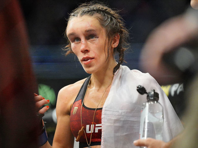 joanna jedrzejczyk forehead