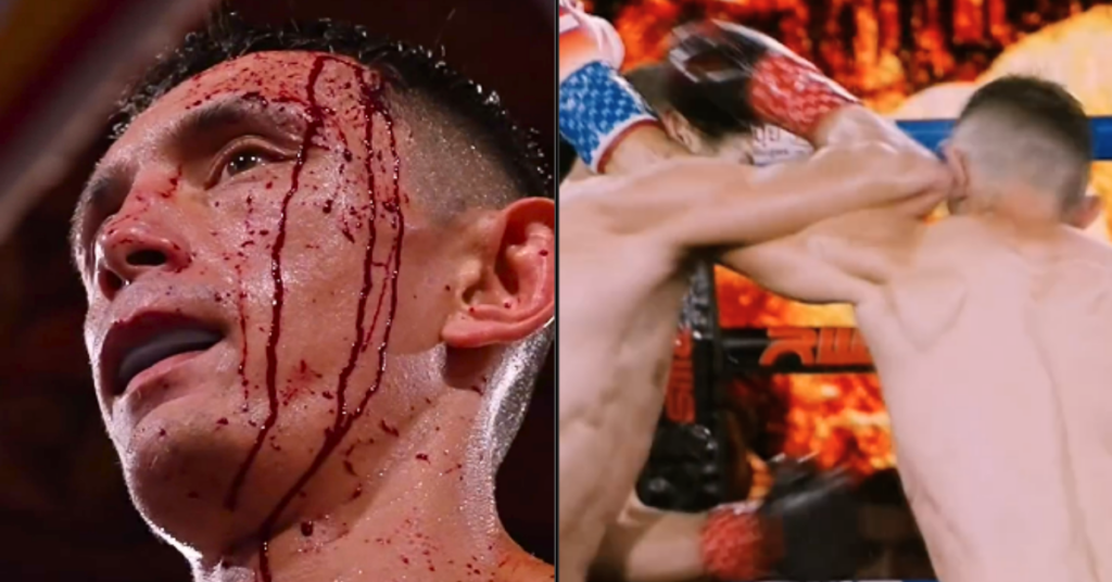 Watch Bloodied Muay Thai fighter Unable to Continue After Slicing Elbow